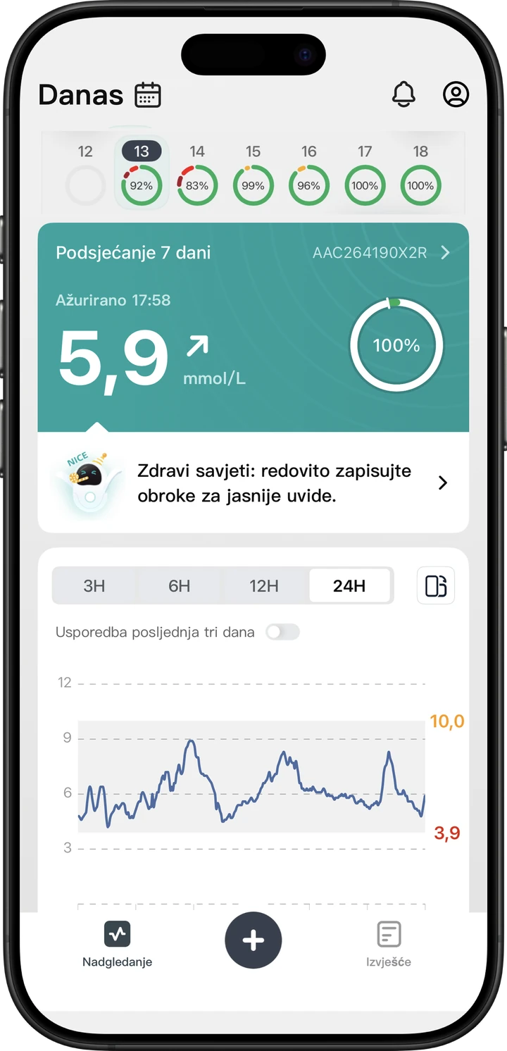 Graf glukoze za zadnja 24 sata